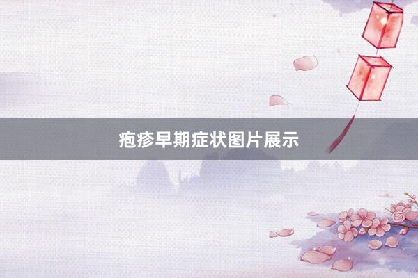 疱疹早期症状图片展示